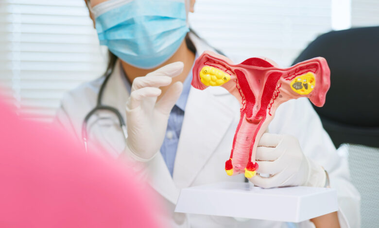 Free PCOS Screenings and OB-GYN Consultations in Mercury Drug this May